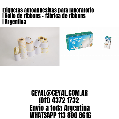 Etiquetas autoadhesivas para laboratorio | Rollo de ribbons – fábrica de ribbons | Argentina