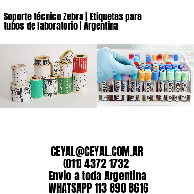 Soporte técnico Zebra | Etiquetas para tubos de laboratorio | Argentina